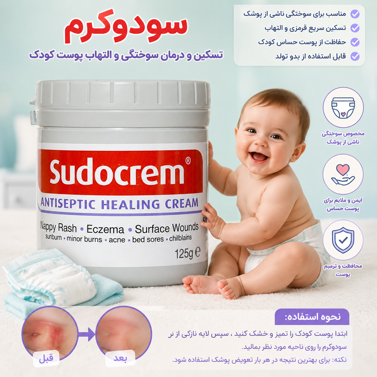کرم سوختگی سودو کرم